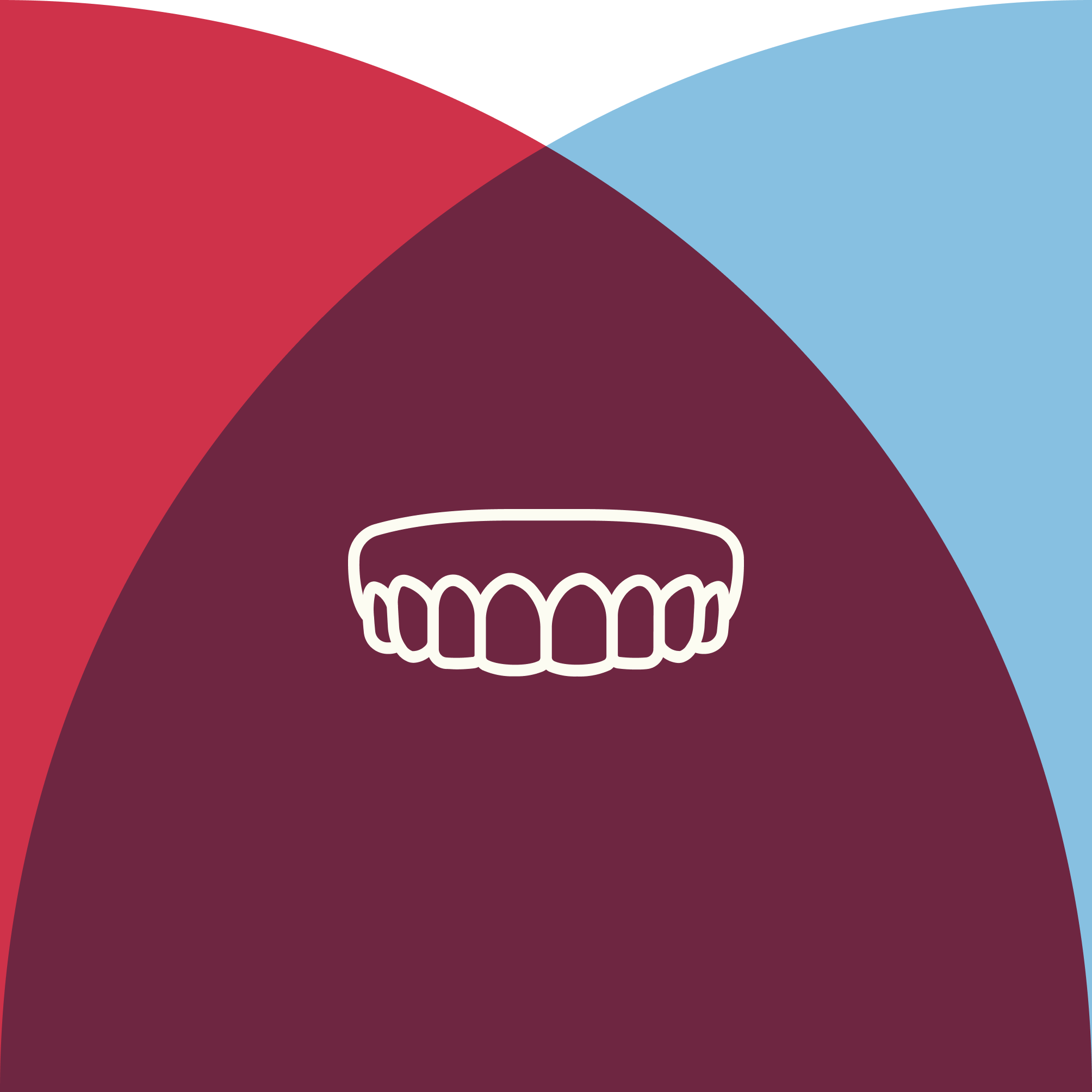 Illustration of a full-arch dental implant bridge representing All-on-4 dental implants.